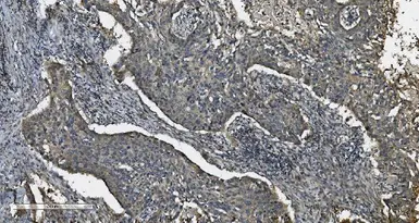 Anti-MAP3K8 antibody used in IHC (Paraffin sections) (IHC-P). GTX03357