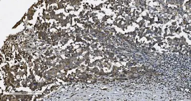 Anti-MAP3K8 antibody used in IHC (Paraffin sections) (IHC-P). GTX03357