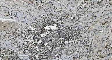 Anti-MAP3K8 antibody used in IHC (Paraffin sections) (IHC-P). GTX03357