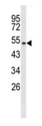 Anti-MUTYH antibody used in Western Blot (WB). GTX03360