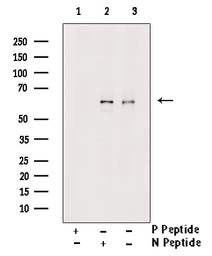 Anti-PLK1 (phospho Thr210) antibody used in Western Blot (WB). GTX03368