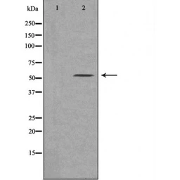 Anti-MSR1 antibody used in Western Blot (WB). GTX03371