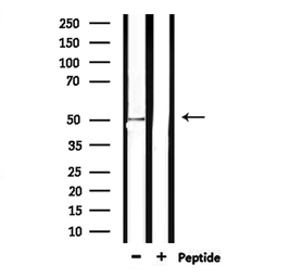 Anti-MSR1 antibody used in Western Blot (WB). GTX03371