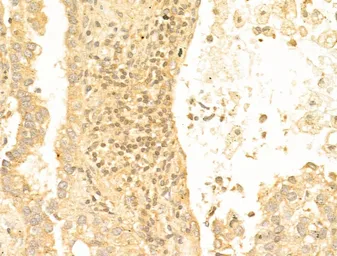 Anti-FOXO1 (Acetyl Lys294) antibody used in IHC (Paraffin sections) (IHC-P). GTX03372