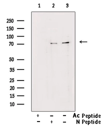 Anti-FOXO1 (Acetyl Lys294) antibody used in Western Blot (WB). GTX03372