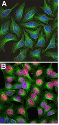 Anti-c-Fos antibody used in Immunocytochemistry/ Immunofluorescence (ICC/IF). GTX03375