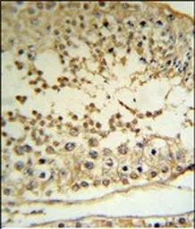 Anti-PRAME antibody used in IHC (Paraffin sections) (IHC-P). GTX03381