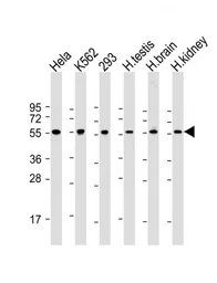 Anti-PRAME antibody used in Western Blot (WB). GTX03381