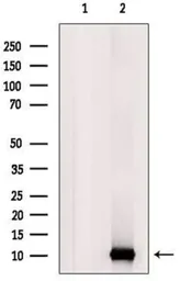 Anti-UFM1 antibody used in Western Blot (WB). GTX03387