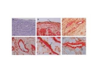 Anti-Gremlin 1 antibody used in IHC (Paraffin sections) (IHC-P). GTX03394