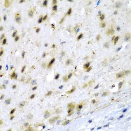 Anti-TPH2 antibody used in IHC (Paraffin sections) (IHC-P). GTX03395