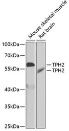 Anti-TPH2 antibody used in Western Blot (WB). GTX03395