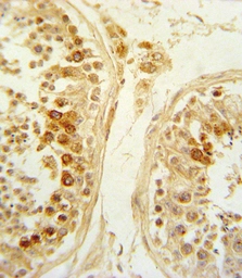 Anti-SFRP1 antibody used in IHC (Paraffin sections) (IHC-P). GTX03397