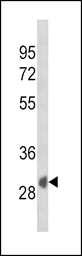 Anti-SFRP1 antibody used in Western Blot (WB). GTX03397