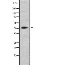 Anti-LAT1 / SLC7A5 antibody used in Western Blot (WB). GTX03401