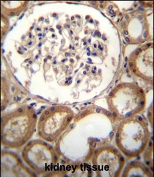 Anti-CLEC18A antibody used in IHC (Paraffin sections) (IHC-P). GTX03404