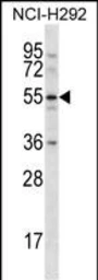 Anti-CLEC18A antibody used in Western Blot (WB). GTX03404