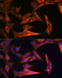 Anti-GAPDH antibody [GT1355] used in Immunocytochemistry/ Immunofluorescence (ICC/IF). GTX03407