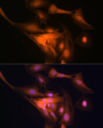 Anti-GAPDH antibody [GT1355] used in Immunocytochemistry/ Immunofluorescence (ICC/IF). GTX03407