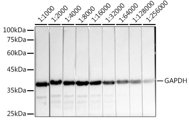 Anti-GAPDH antibody [GT1355] used in Western Blot (WB). GTX03407