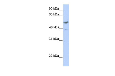 Anti-SIAT4A antibody used in Western Blot (WB). GTX03412