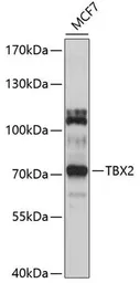 Anti-TBX2 antibody used in Western Blot (WB). GTX03418