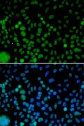 Anti-IRF2 antibody used in Immunocytochemistry/ Immunofluorescence (ICC/IF). GTX03422