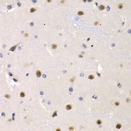 Anti-IRF2 antibody used in IHC (Paraffin sections) (IHC-P). GTX03422