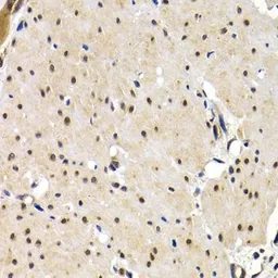 Anti-IRF2 antibody used in IHC (Paraffin sections) (IHC-P). GTX03422