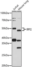 Anti-IRF2 antibody used in Western Blot (WB). GTX03422