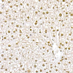 Anti-MUC2 antibody used in IHC (Paraffin sections) (IHC-P). GTX03424