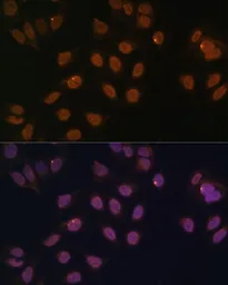 Anti-FOXG1 antibody used in Immunocytochemistry/ Immunofluorescence (ICC/IF). GTX03427