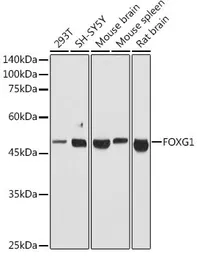 Anti-FOXG1 antibody used in Western Blot (WB). GTX03427