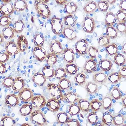 Anti-BMP7 antibody used in IHC (Paraffin sections) (IHC-P). GTX03429