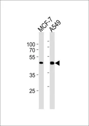 Anti-CCRK antibody [885CT27.1.1] used in Western Blot (WB). GTX03437
