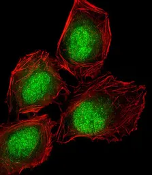 Anti-DLL3 antibody used in Immunocytochemistry/ Immunofluorescence (ICC/IF). GTX03439
