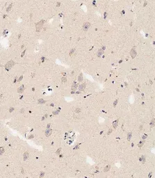 Anti-DLL3 antibody used in IHC (Paraffin sections) (IHC-P). GTX03439