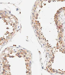 Anti-DLL3 antibody used in IHC (Paraffin sections) (IHC-P). GTX03439