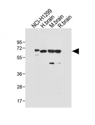 Anti-DLL3 antibody used in Western Blot (WB). GTX03439