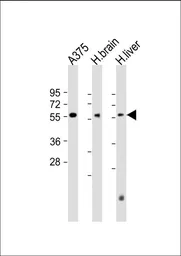 Anti-DLL3 antibody used in Western Blot (WB). GTX03439