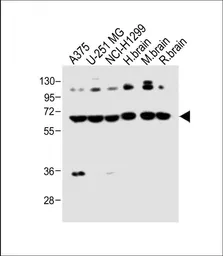 Anti-DLL3 antibody used in Western Blot (WB). GTX03439