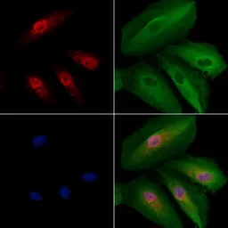 Anti-A-Myb antibody used in Immunocytochemistry/ Immunofluorescence (ICC/IF). GTX03441