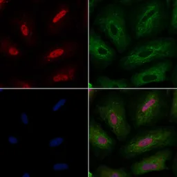 Anti-A-Myb antibody used in Immunocytochemistry/ Immunofluorescence (ICC/IF). GTX03441