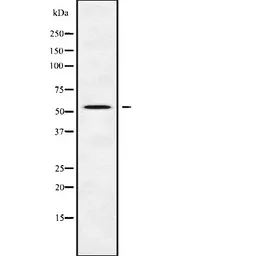 Anti-DFNA5 antibody used in Western Blot (WB). GTX03443