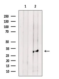 Anti-EB1 antibody used in Western Blot (WB). GTX03450