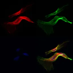 Anti-NG2 antibody used in Immunocytochemistry/ Immunofluorescence (ICC/IF). GTX03452