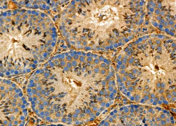 Anti-NG2 antibody used in IHC (Paraffin sections) (IHC-P). GTX03452