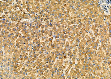 Anti-NG2 antibody used in IHC (Paraffin sections) (IHC-P). GTX03452