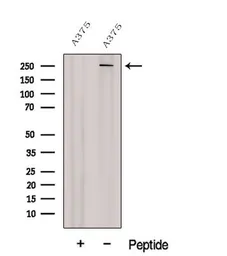 Anti-NG2 antibody used in Western Blot (WB). GTX03452