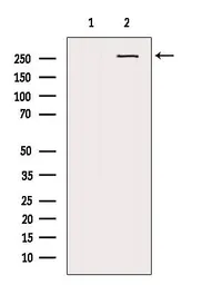 Anti-NG2 antibody used in Western Blot (WB). GTX03452